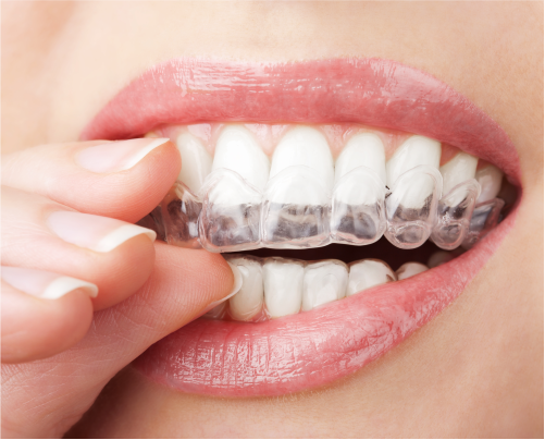 Tratament estetica dentara cabinet stomatologic sector 2 No Pain