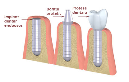 Cabinet stomatologic sector 2 preturi