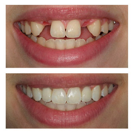 Implant dentar stomatologie sector 2