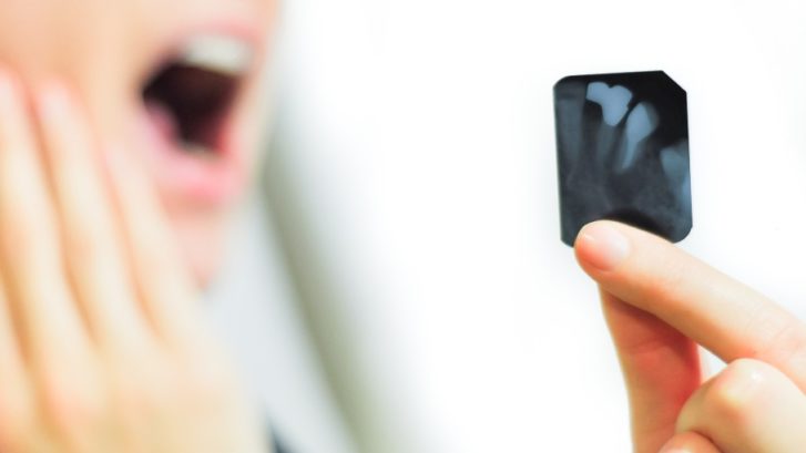 Tratamentul endodontic